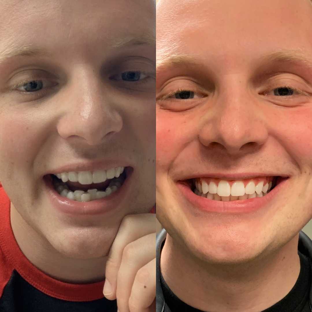 27
